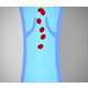 The FirstKind Geko Device Reduces Clotting 8