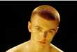 Jaundice-Like Juvenile Pictorials