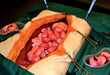 Disgusting Surgical Desserts