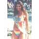 Former Miss Argentina's Tragic Complications from Gluteoplasty 7