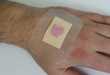 Intuitive Infection Aids