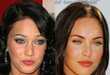 10 A-Listers Who Went Under the Knife